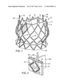 PROSTHETIC HEART VALVE DELIVERY APPARATUS diagram and image