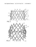 PROSTHETIC HEART VALVE DELIVERY APPARATUS diagram and image