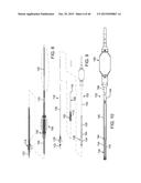 PROSTHETIC HEART VALVE DELIVERY APPARATUS diagram and image