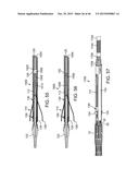 PROSTHETIC HEART VALVE DELIVERY APPARATUS diagram and image