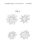 TRUNCATED CONE HEART VALVE STENT diagram and image