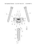 REVERSE SHOULDER SYSTEMS AND METHODS diagram and image