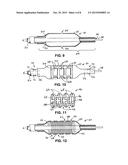 Methods and Devices for Treating a Bodily Lumen with In Situ Generated     Structural Support diagram and image