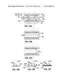 Methods and Devices for Treating a Bodily Lumen with In Situ Generated     Structural Support diagram and image