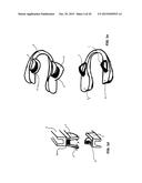 MANDIBULAR ADVANCEMENT DEVICE diagram and image