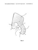 MANDIBULAR ADVANCEMENT DEVICE diagram and image