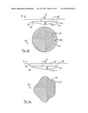 DEVICE AND METHOD FOR PRODUCING CONTROL DATA FOR THE SURGICAL CORRECTION     OF THE DEFECTIVE VISION OF AN EYE diagram and image