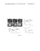 THIOREDOXIN PROTEIN INHIBITORS AND USES THEREOF diagram and image