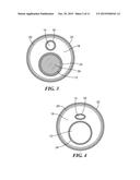 MULTI-LUMEN DEVICE WITH NON COLLAPSABLE MINOR LUMEN diagram and image