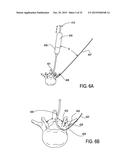 DEVICES AND METHODS FOR TREATING TISSUE diagram and image