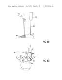 DEVICES AND METHODS FOR TREATING TISSUE diagram and image