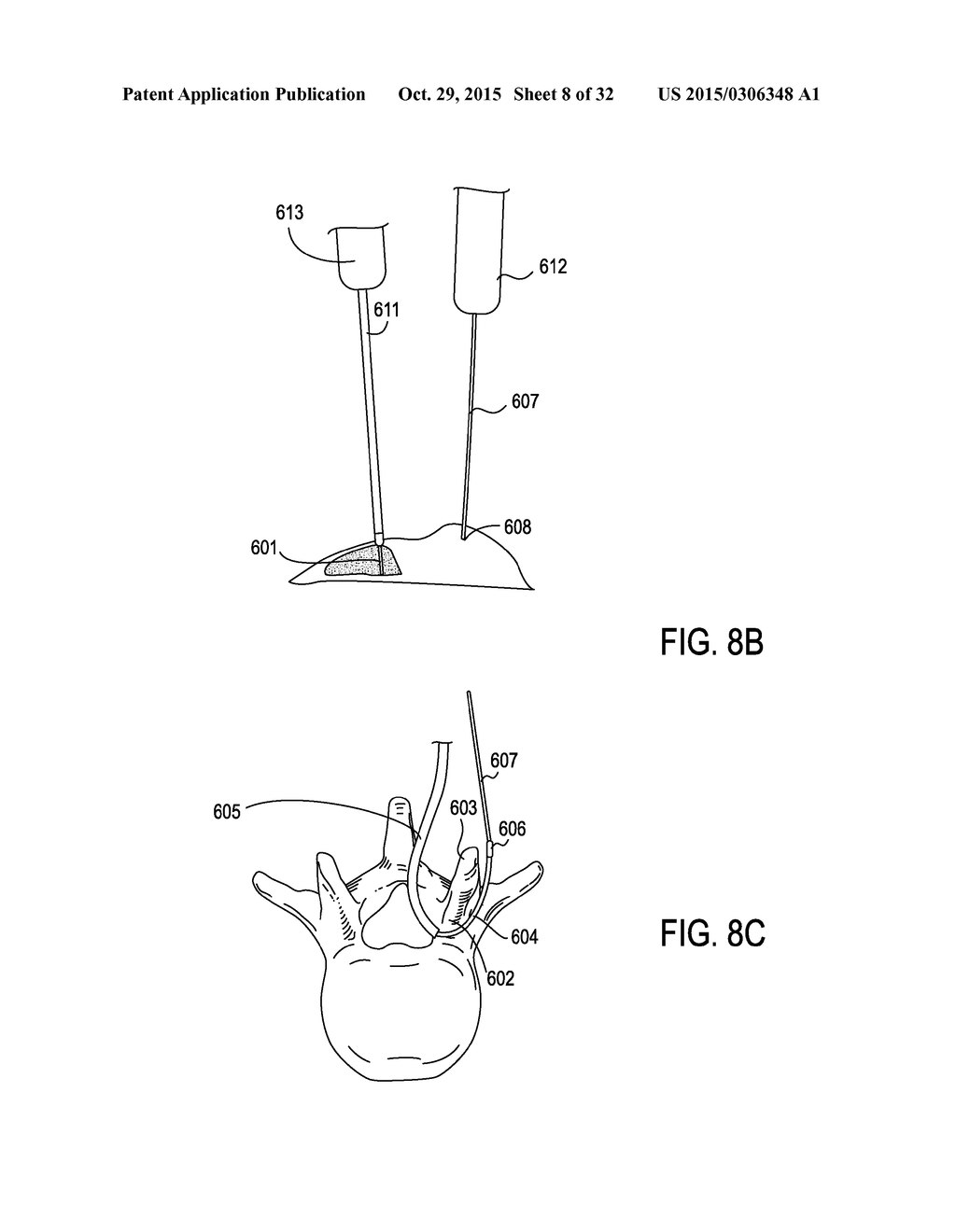 DEVICES AND METHODS FOR TREATING TISSUE - diagram, schematic, and image 09