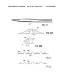 DEVICES AND METHODS FOR TREATING TISSUE diagram and image