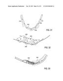 DEVICES AND METHODS FOR TREATING TISSUE diagram and image