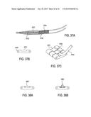 DEVICES AND METHODS FOR TREATING TISSUE diagram and image