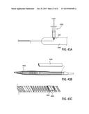 DEVICES AND METHODS FOR TREATING TISSUE diagram and image