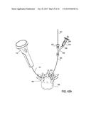 DEVICES AND METHODS FOR TREATING TISSUE diagram and image