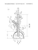 Catheter Guide and Method for Utilizing the Same diagram and image