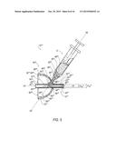 Catheter Guide and Method for Utilizing the Same diagram and image