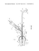 Catheter Guide and Method for Utilizing the Same diagram and image