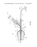 Catheter Guide and Method for Utilizing the Same diagram and image