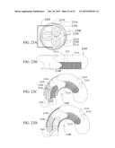 Guidewires with variable rigidity diagram and image