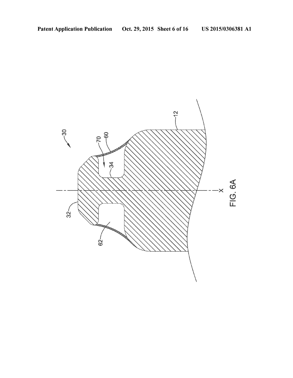 LEADLESS CARDIAC PACEMAKER WITH RETRIEVAL FEATURES - diagram, schematic, and image 07