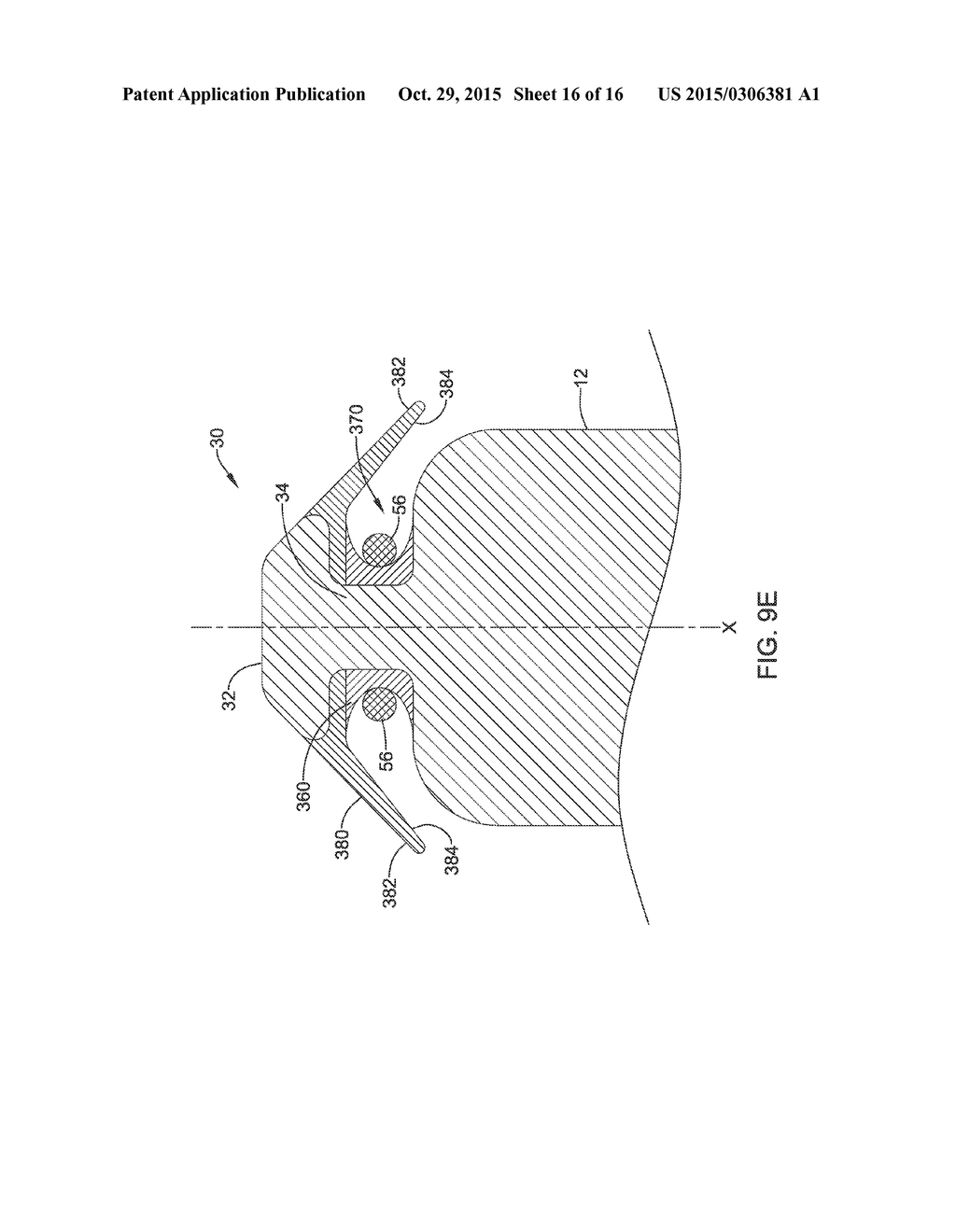 LEADLESS CARDIAC PACEMAKER WITH RETRIEVAL FEATURES - diagram, schematic, and image 17