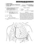 METHOD AND APPARATUS FOR ADJUSTING A BLANKING PERIOD DURING TRANSITIONING     BETWEEN OPERATING STATES IN A MEDICAL DEVICE diagram and image