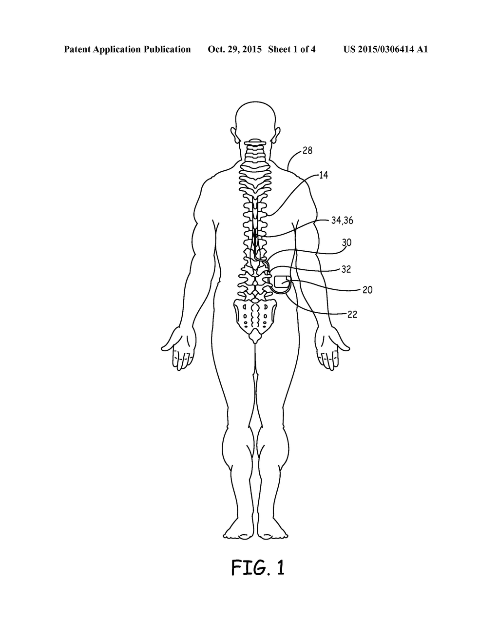 IMPLANTABLE DEVICE WITH OPTICAL LEAD CONNECTOR - diagram, schematic, and image 02