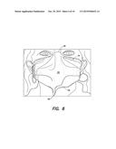 A FILTER MASK HAVING ONE OR MORE MALLEABLE STIFFENING MEMBERS diagram and image