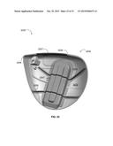 GOLF CLUB HEAD WITH INTERNAL CAP diagram and image