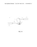 SYSTEMS, DEVICES, AND METHODS FOR SANDING A SURFACE USING A SANDING SLEEVE diagram and image