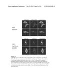 METHODS AND COMPOSITIONS FOR INHIBITING CNKSR1 diagram and image