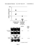 METHODS AND PHARMACEUTICAL COMPOSITIONS FOR THE TREATMENT OF BONE     METASTASES diagram and image