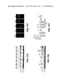COMPOSITIONS AND METHODS FOR PROGNOSIS AND TREATMENT OF CANCER diagram and image
