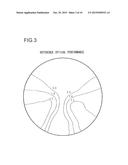 METHOD FOR DESIGNING SPECTACLE LENS, AND SYSTEM FOR DESIGNING SPECTACLE     LENS diagram and image