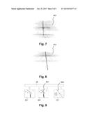 METHOD AND DEVICE FOR IMAGE-ASSISTED RUNWAY LOCALIZATION diagram and image