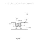 Anchoring Structure and Intermeshing Structure diagram and image