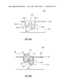 Anchoring Structure and Intermeshing Structure diagram and image
