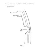 Variable Resolution Eye Mounted Displays diagram and image