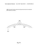 Variable Resolution Eye Mounted Displays diagram and image