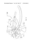 WRAPPING DEVICE diagram and image