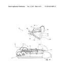 CUTTING SYSTEM diagram and image