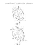 METHOD AND SYSTEM FOR DISPLAYING A THREE DIMENSIONAL VISUALIZATION OF     CARDIAC MOTION diagram and image