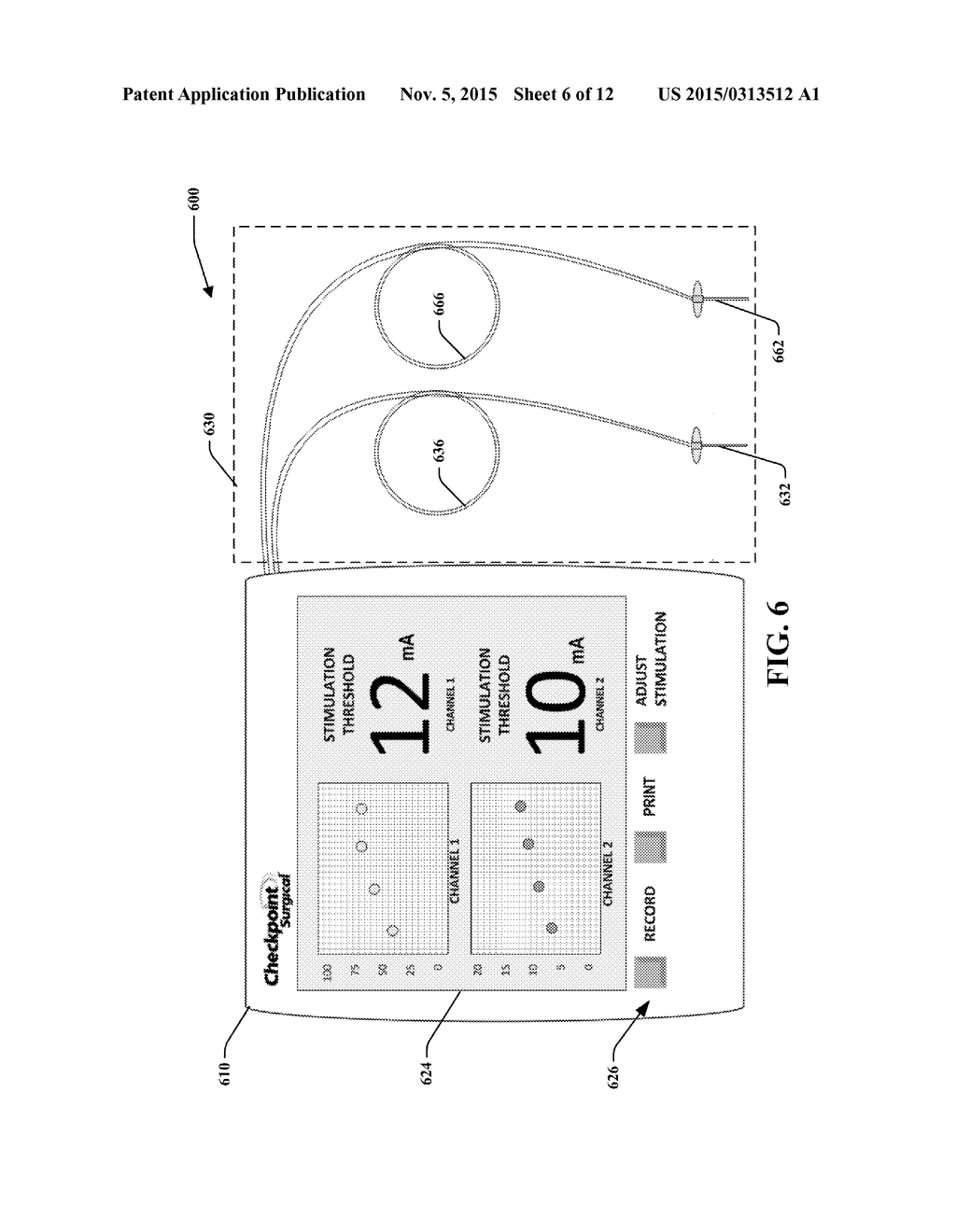 PERCUTANEOUS STIMULATION DEVICE AND METHOD FOR DETECTING COMPARTMENT     SYNDROME - diagram, schematic, and image 07