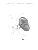 FETAL MONITORING DEVICE AND METHODS diagram and image