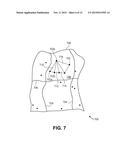 Method and System to Subdivide a Mapping Area for Mechanical Activation     Analysis diagram and image