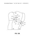 Method and System to Subdivide a Mapping Area for Mechanical Activation     Analysis diagram and image