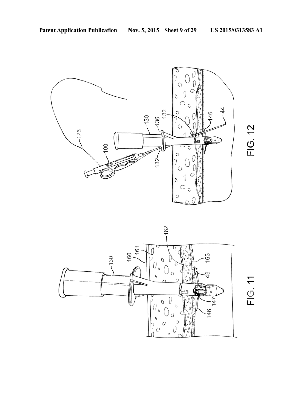 NEEDLE AND SNARE GUIDE APPARATUS FOR PASSING SUTURE - diagram, schematic, and image 10